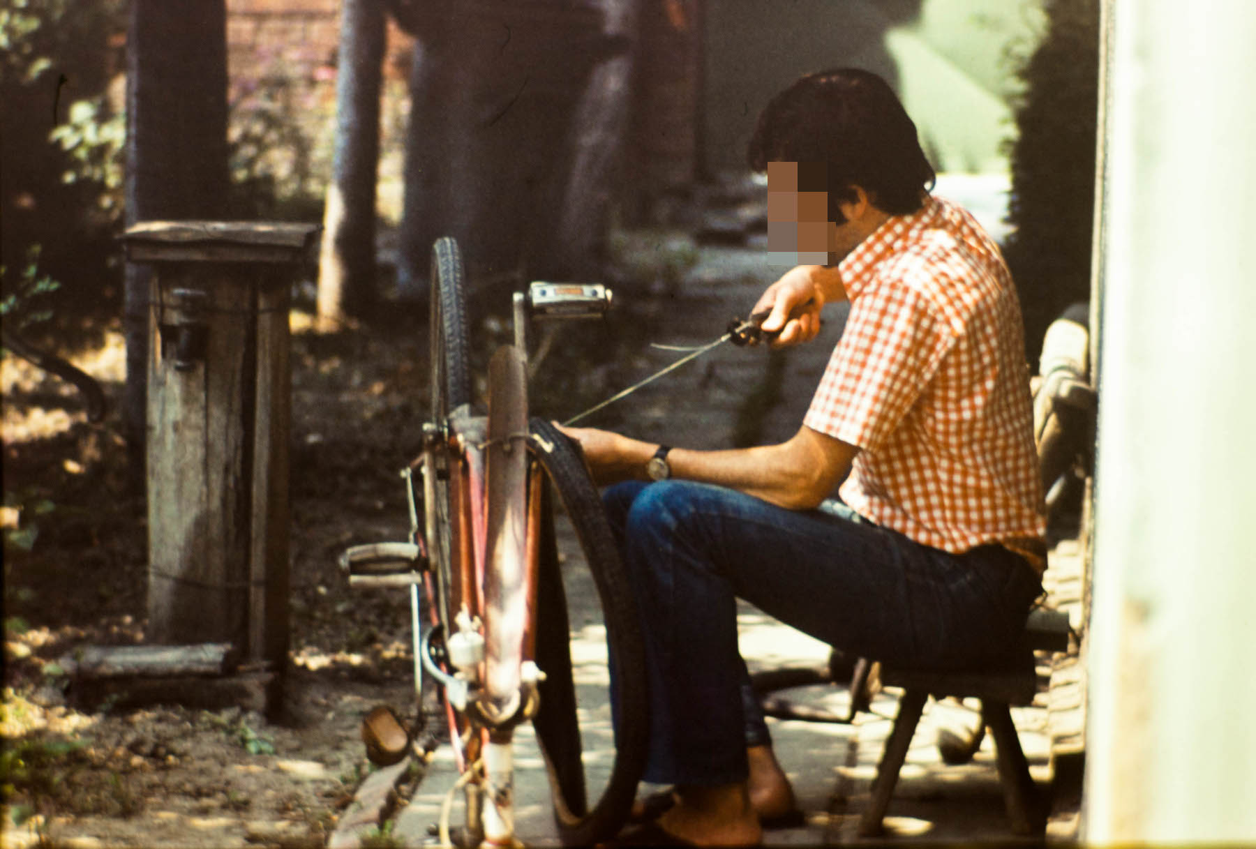 Истина. Пукла му спољна, ушивао је жицом, телефонском парицом.